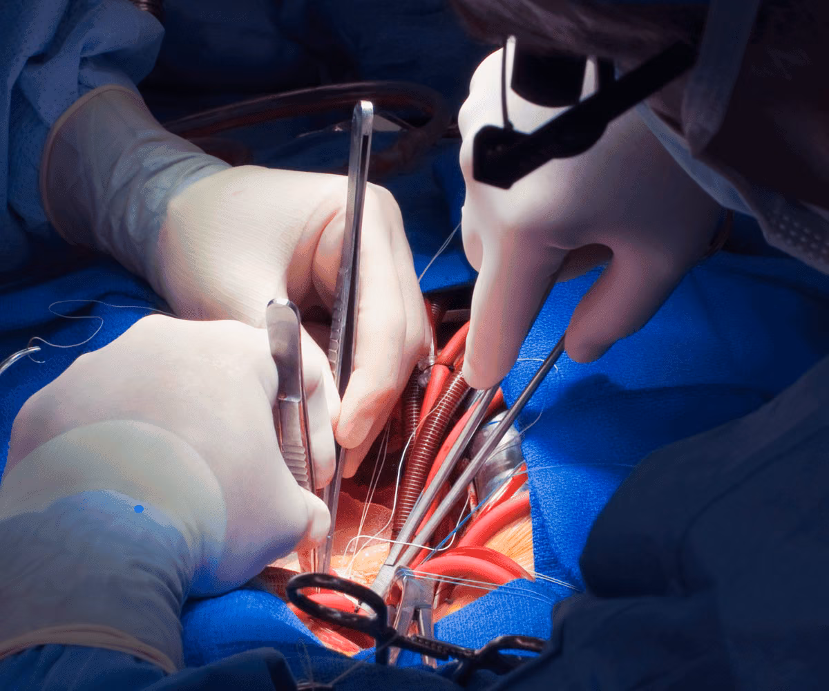 DVT Procedure